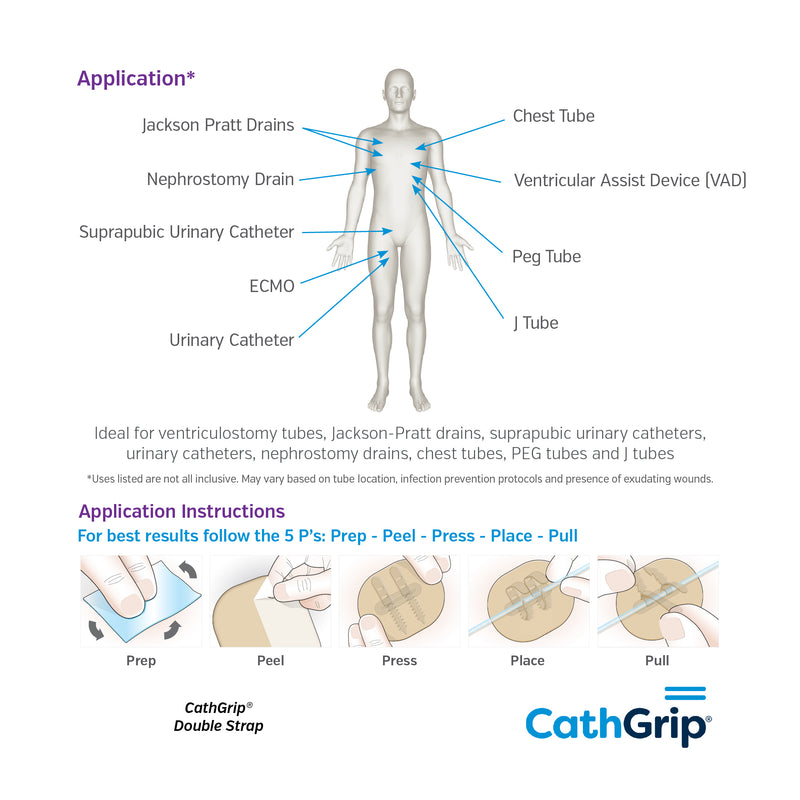CathGrip® Tube Securement Device (100 x 120mm, Double Strap, Large, Non-Sterile)