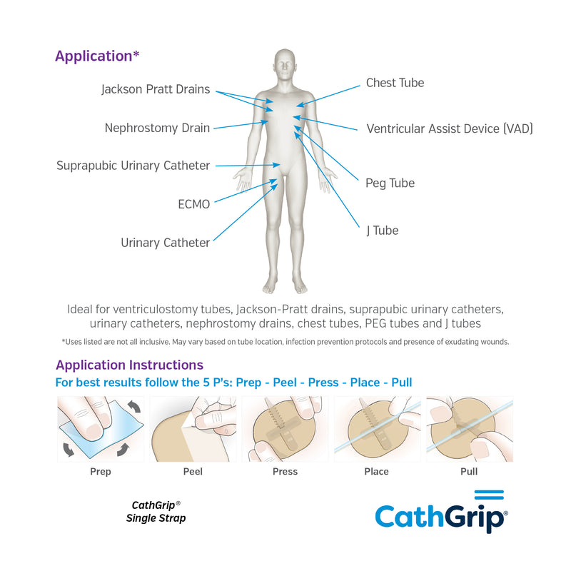 CathGrip® Tube Securement Device (76 x 90mm, Single Strap, Small, Non-Sterile)